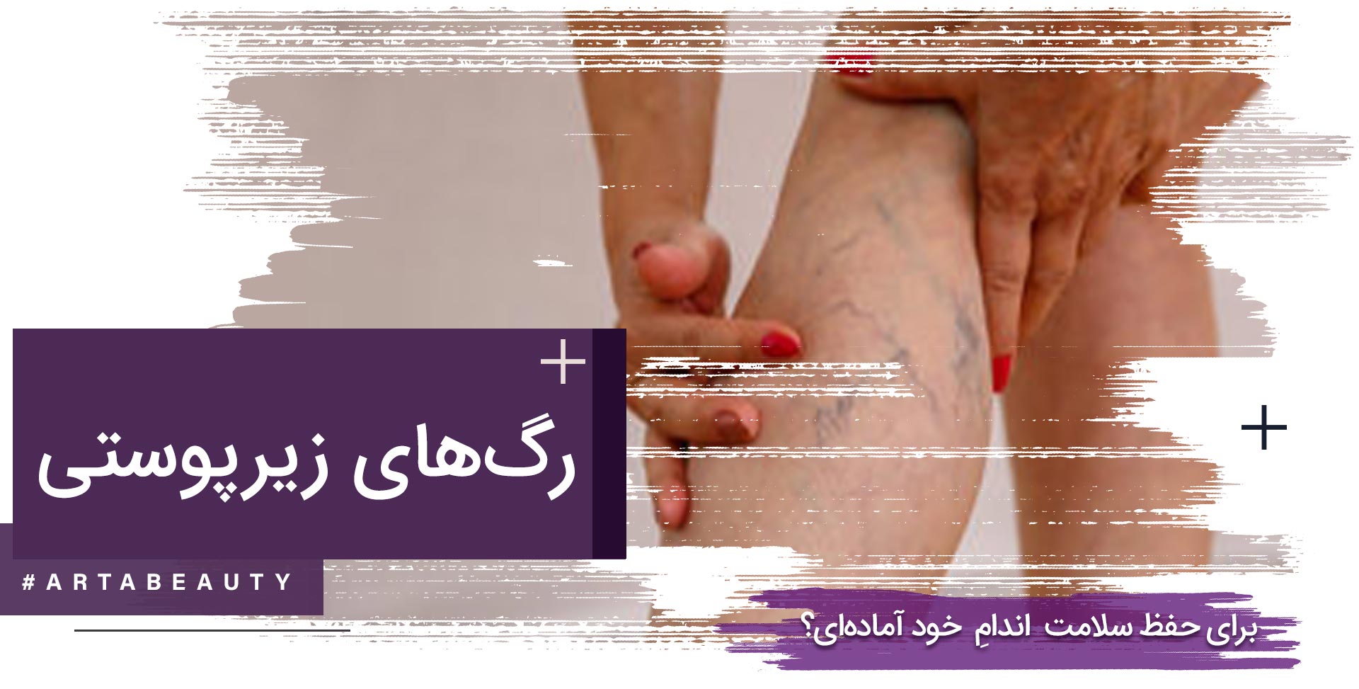 رگ های زیر پوستی