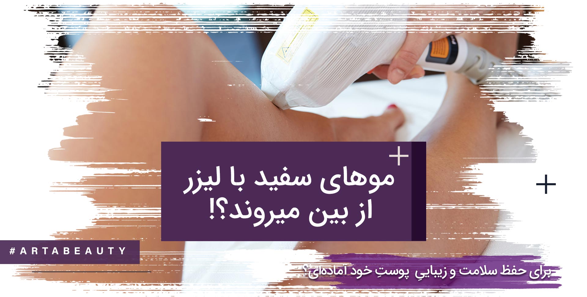 آیا از بین بردن موهای سفید با لیزر امکان پذیر است ؟
