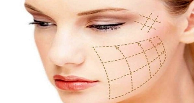 مراقبت های بعد از لیفت با نخ
