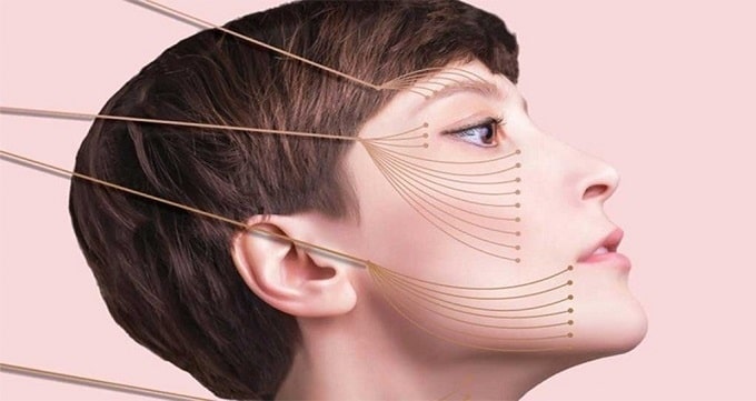 ماندگاری لیفت صورت چقدر است؟