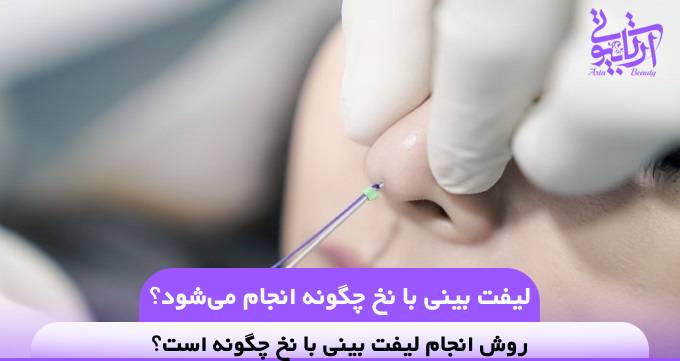 لیفت بینی با نخ چگونه انجام می‌شود؟❤️【سال1404】✅