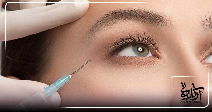 بوتاکس دور چشم در کلینیک آرتا بیوتی