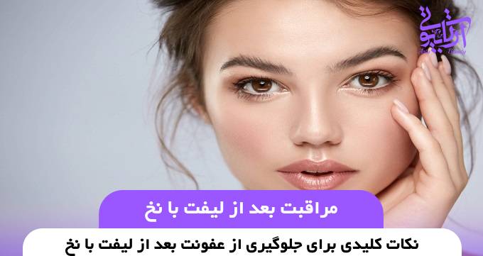 مراقبت بعد از لیفت با نخ❤️【سال1404】✅