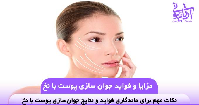 مزایا و فواید جوان سازی پوست با نخ❤️【سال1404】💎