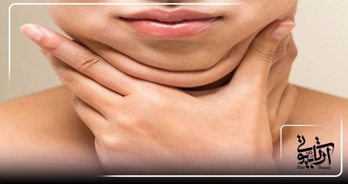 لیپوماتیک غبغب در آرتابیوتی
