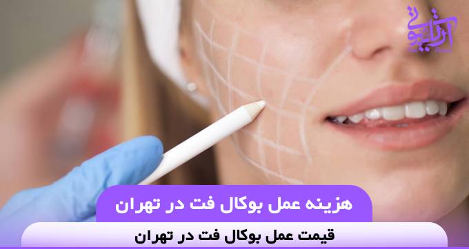 هزینه عمل بوکال فت در تهران⭐【سال1404】✅