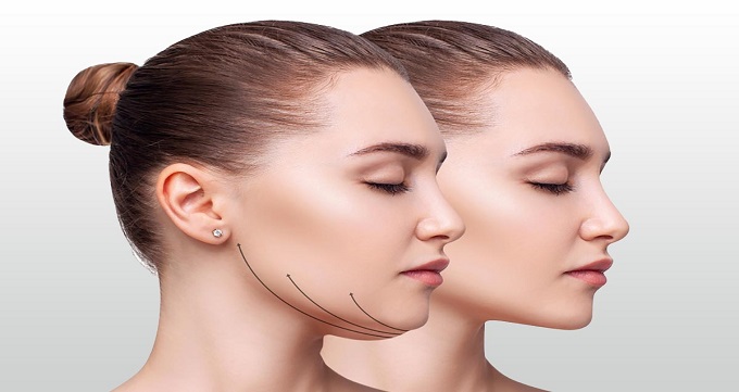 روش های برداشتن غبغب بدون جراحی