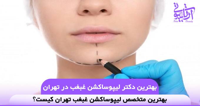 بهترین دکتر لیپوساکشن غبغب در تهران❤️【سال1404】✅