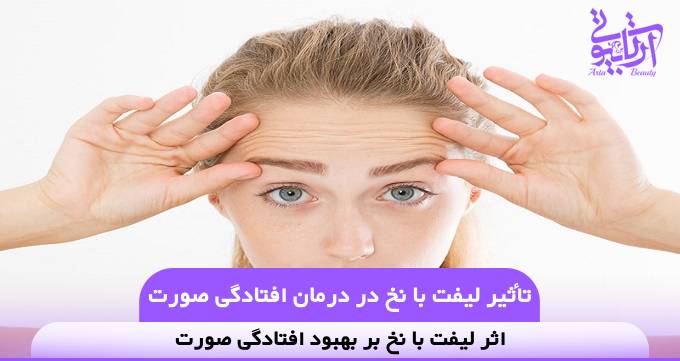تاثیر لیفت با نخ در درمان افتادگی صورت❤️【سال1404】✅