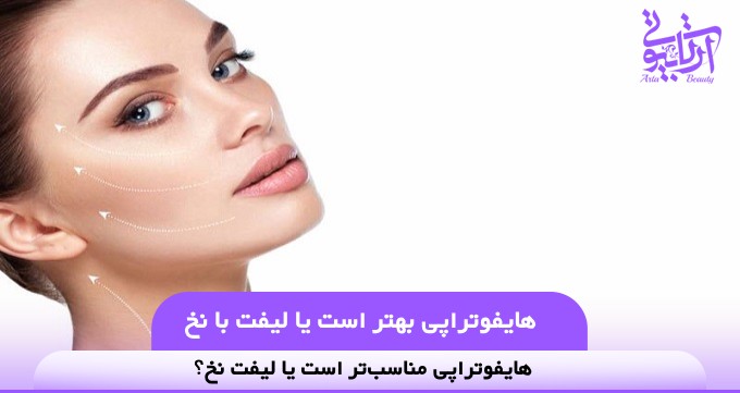 هایفوتراپی بهتر است یا لیفت با نخ❤️【سال1404】✅