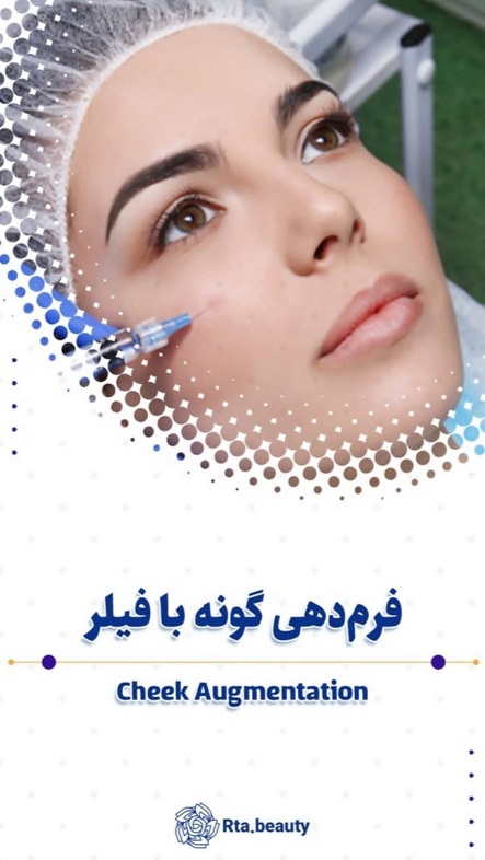 فیلر صورت در آرتابیوتی