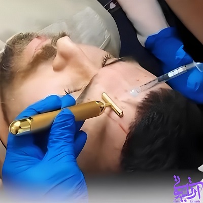 نمونه کار تزریق بوتاکس دکتر جلالی فخر