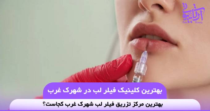 بهترین کلینیک فیلر لب در شهرک غرب