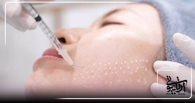 چه کسانی کاندیدای مناسب مزوژل هستند؟
