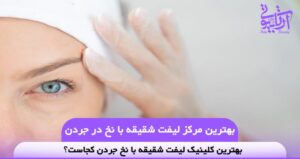 بهترین مرکز لیفت شقیقه با نخ در جردن