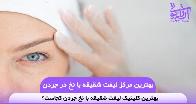 بهترین مرکز لیفت شقیقه با نخ در جردن