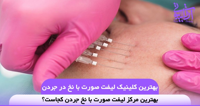 The best thread lift clinic in Jordan