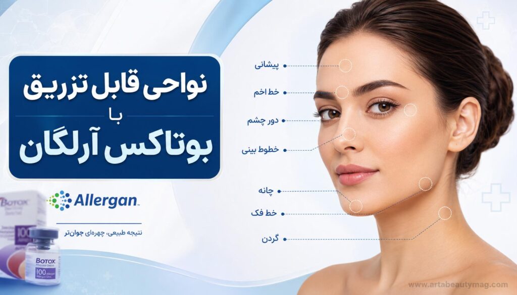 نواحی قابل تزریق با بوتاکس آرلگان
