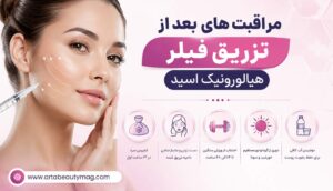 مراقبت های بعد از تزریق فیلر هیالورونیک اسید